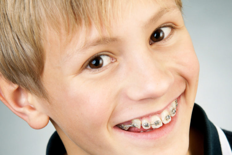 ortodonzia-bambini-verona-studio-dentistico-peretti-cavalleri